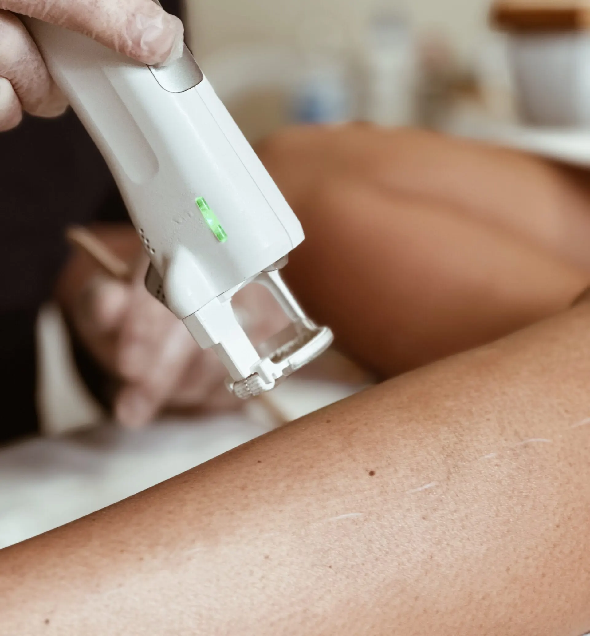 Athena Laser epilation laser
