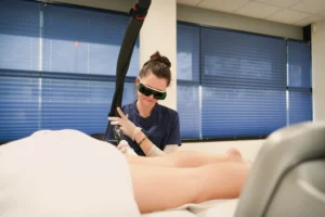 Athena Laser laser pigmentaire