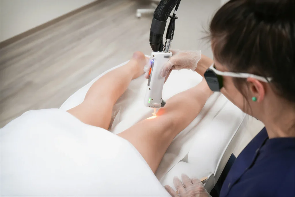 image slider epilation laser