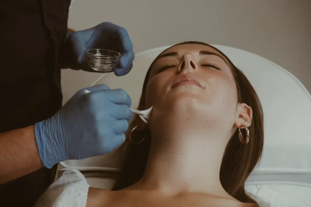 Athena Laser peeling peau