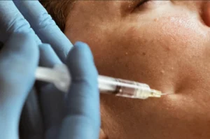 Athena Laser mesotherapie