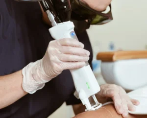 Athena Laser pilosité indésirable