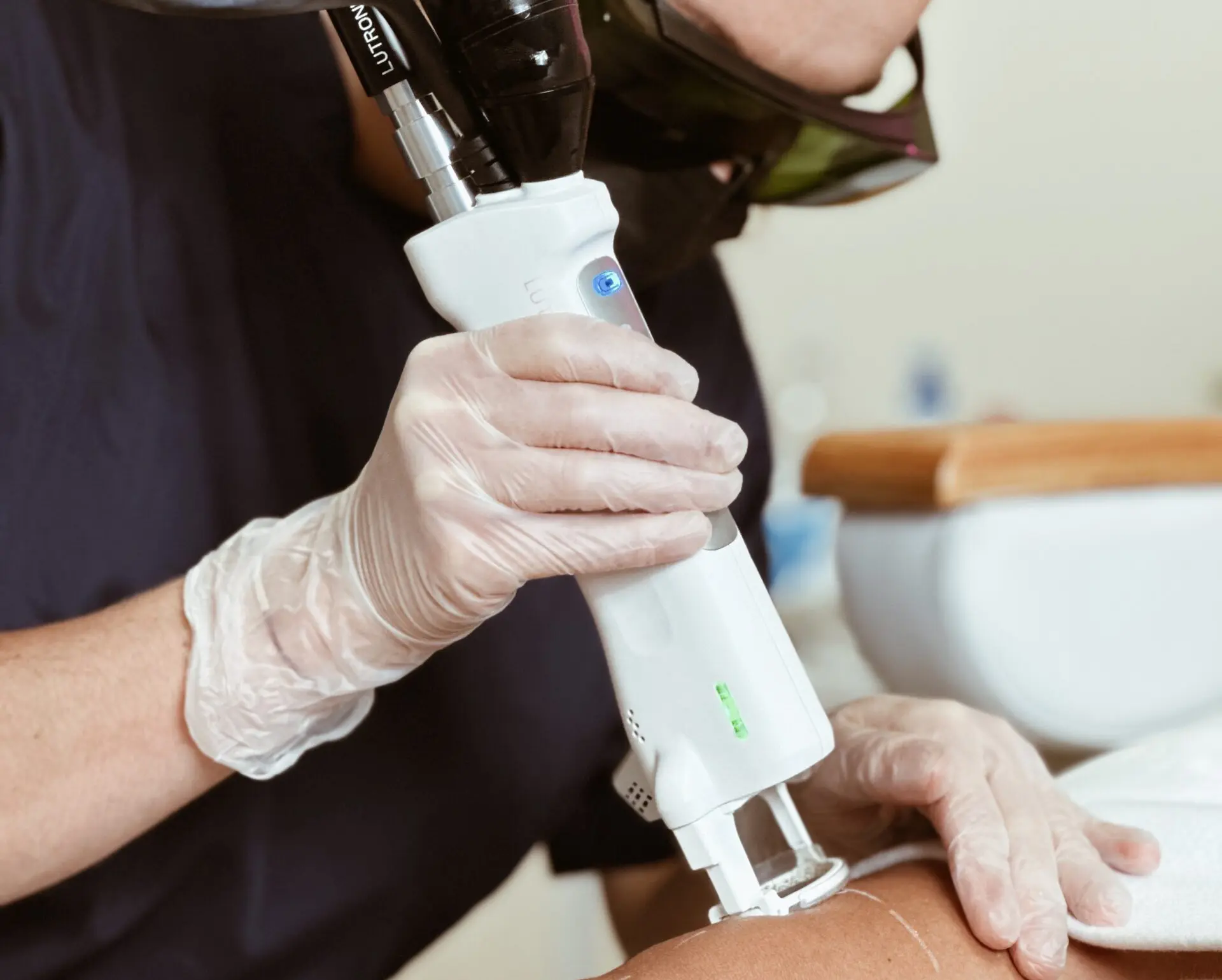 Athena Laser pilosité indésirable