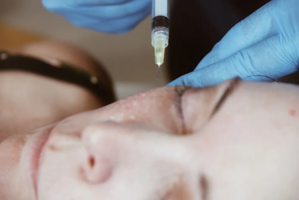 Athena Laser injection