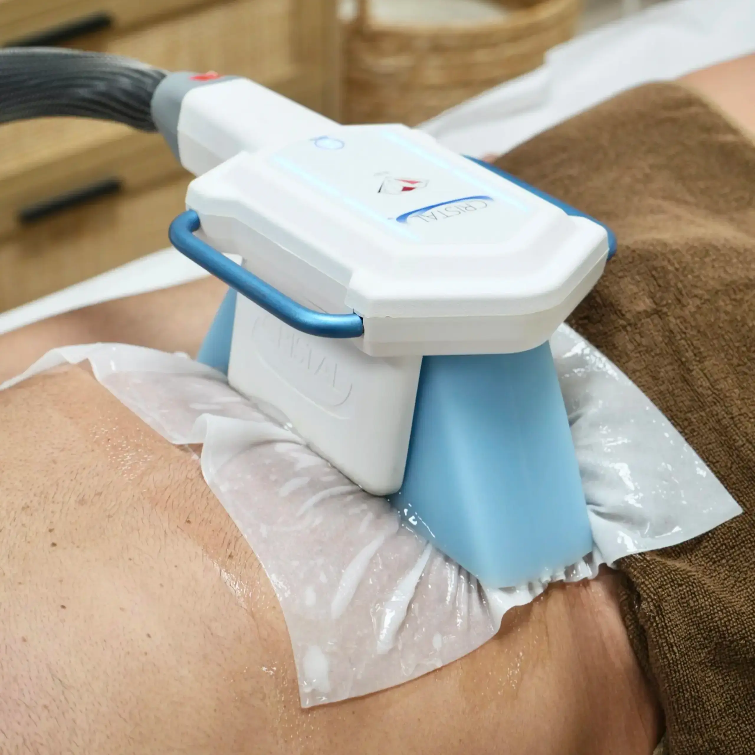 Athena Laser cryolipolyse