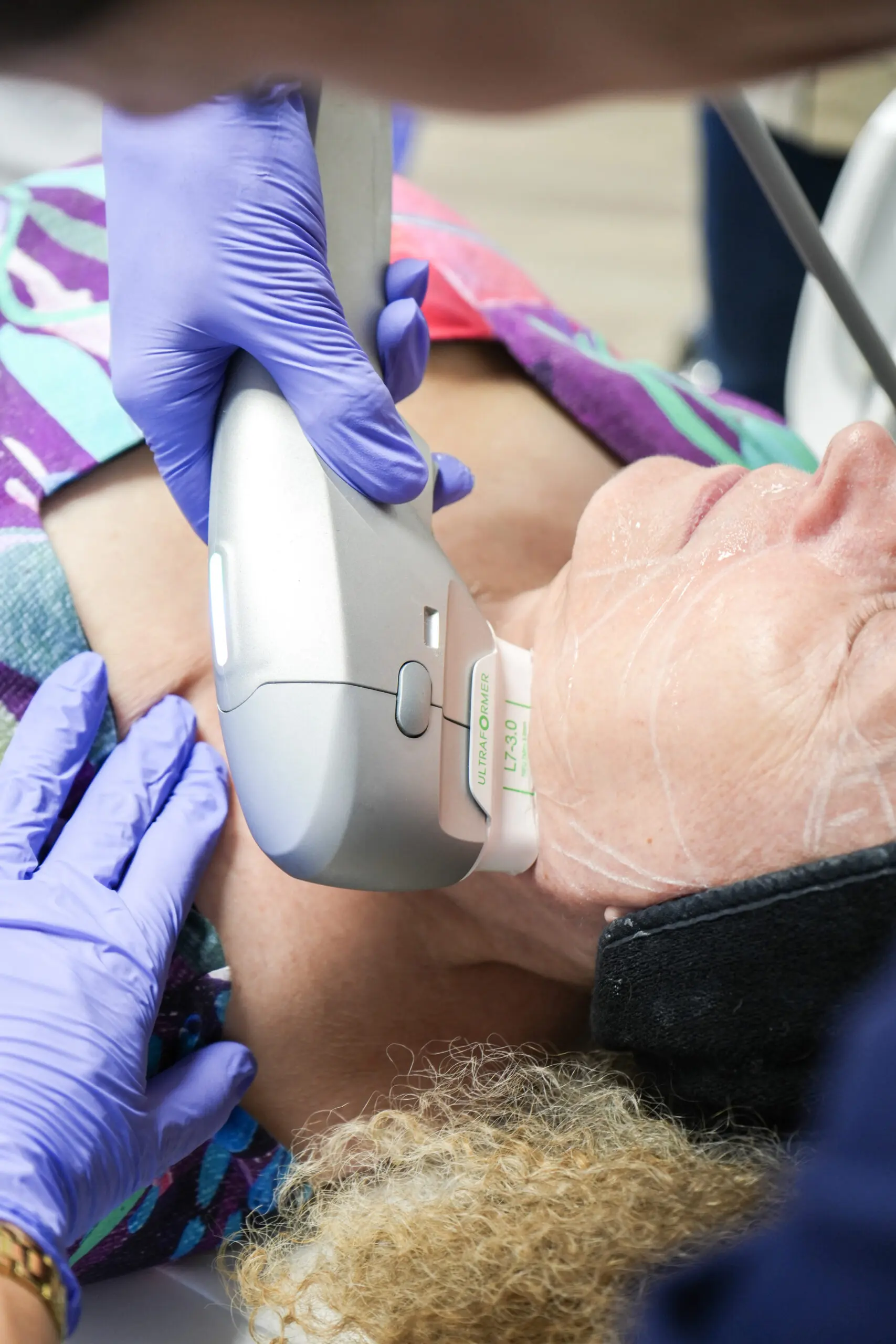 Athena Laser HIFU