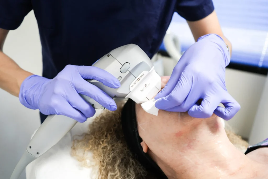 Athena Laser HIFU