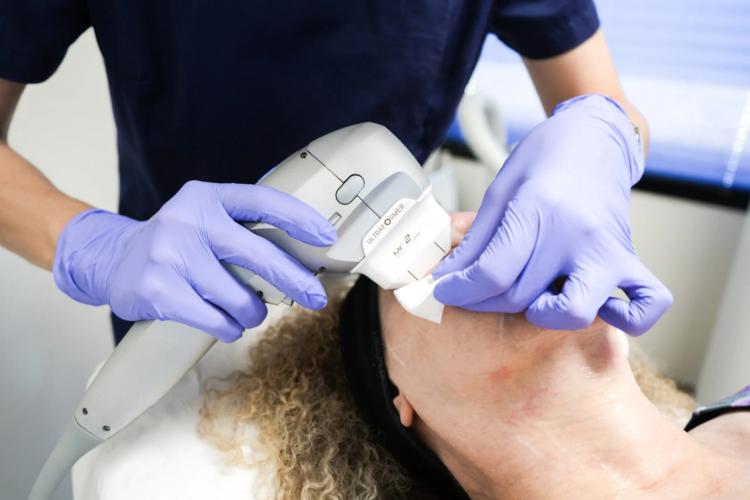 Athena Laser HIFU