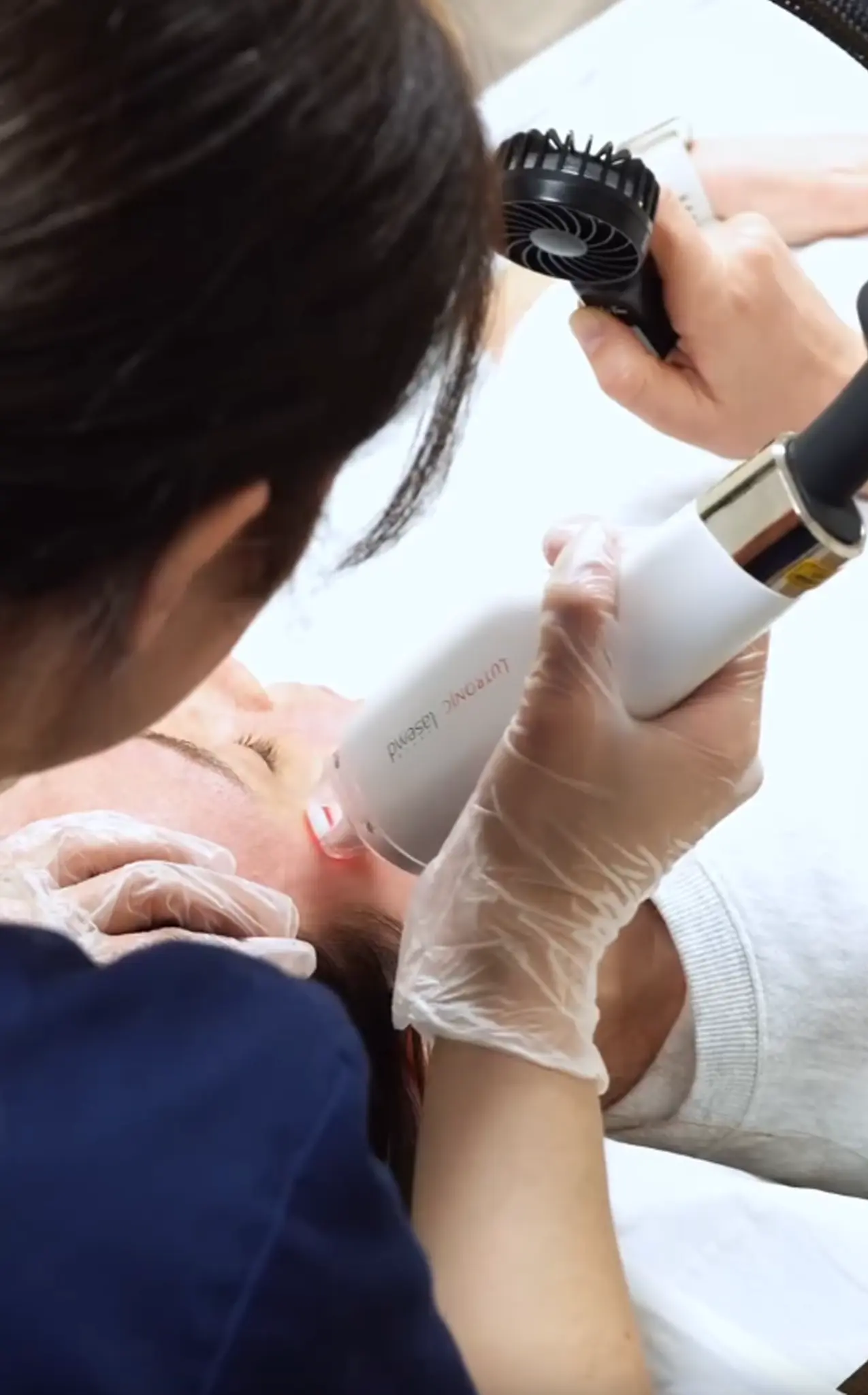 Athena Laser laser md