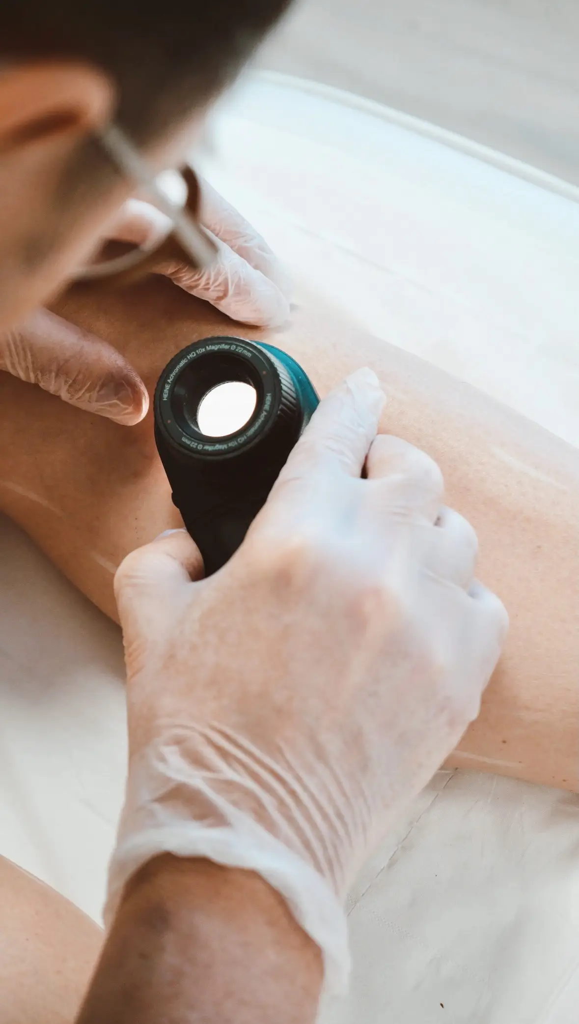 Athena Laser epilation laser