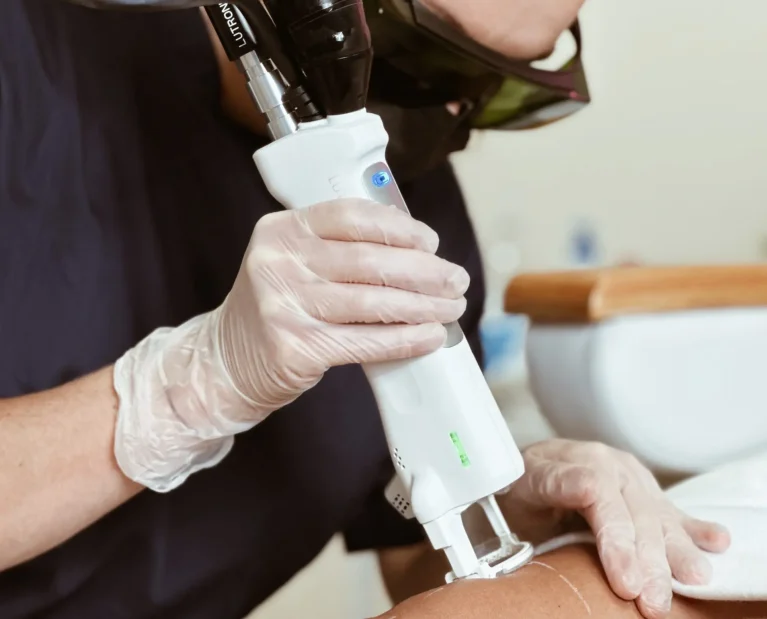 Athena Laser pilosité indésirable