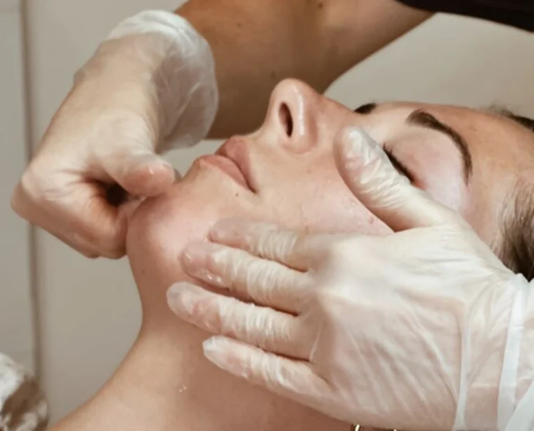 Athena Laser manque d'éclat