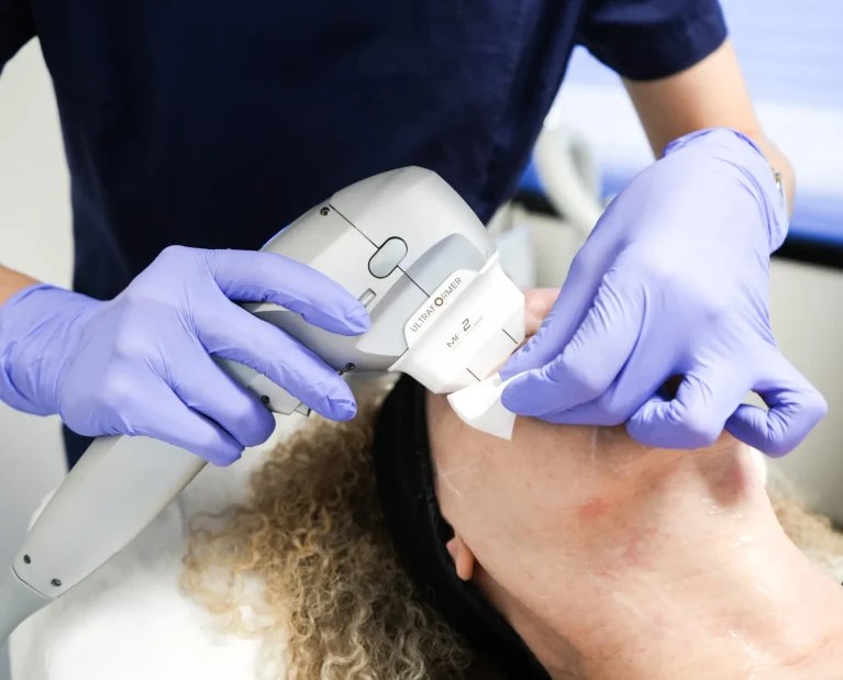 Athena Laser HIFU
