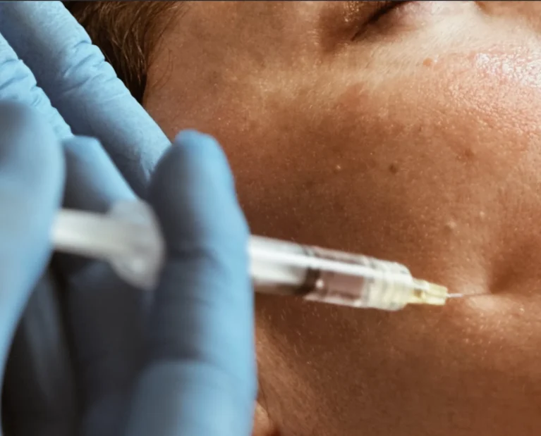Athena Laser mesotherapie