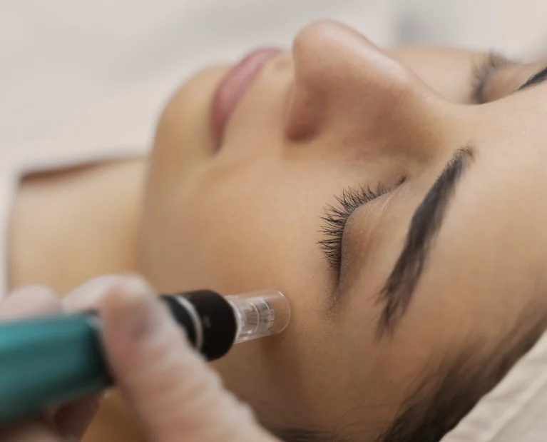 person-getting-micro-needling-beauty-treatment copie