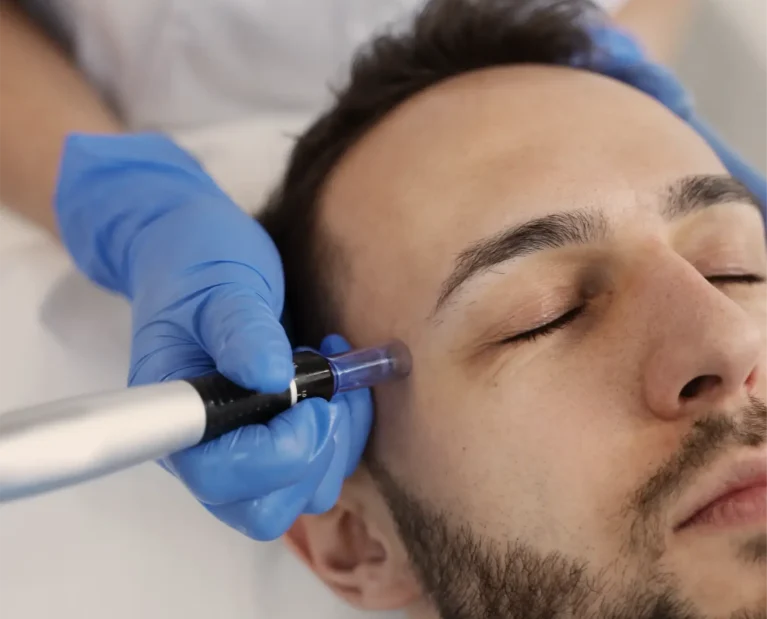 preparing-utensils-microneedling-procedure copie